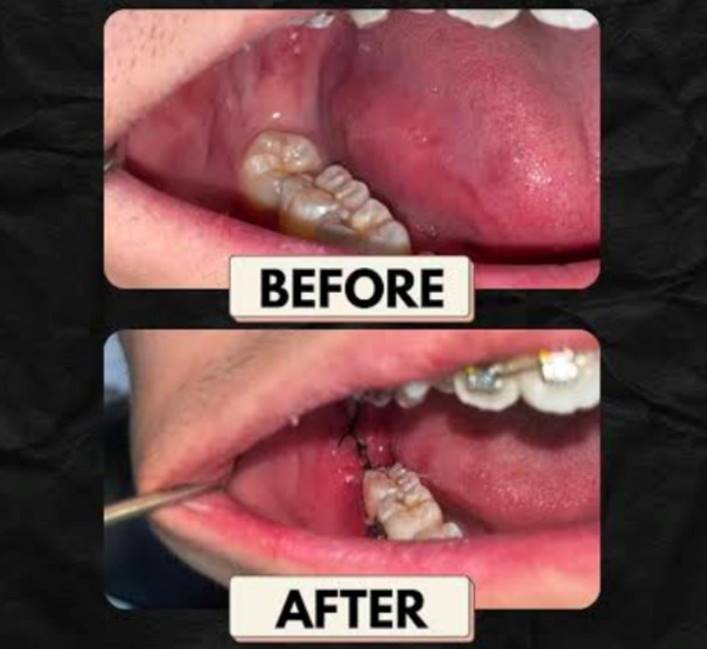 Orthodontic Treatment